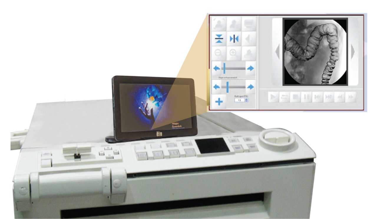GE R/F UPGRADE ADVANTX | Radiologysolutionsdr